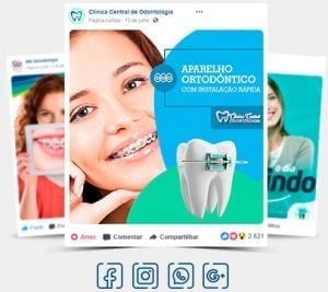 Posts para Instagram de Dentista
