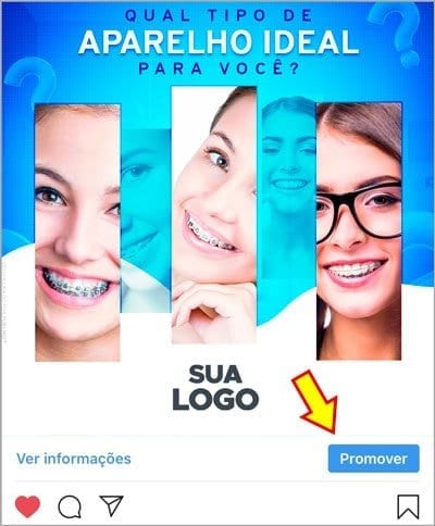 Marketing Odontológico: Como criar anúncios no Instagram para Dentista