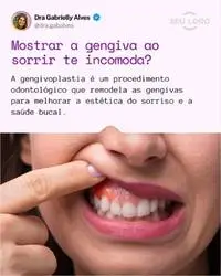 Posts para Dentistas - Publiko