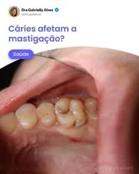 Posts para Dentistas - Publiko