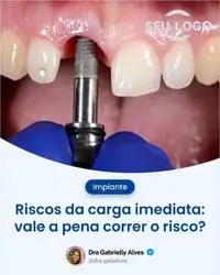 Posts para Dentistas - Publiko